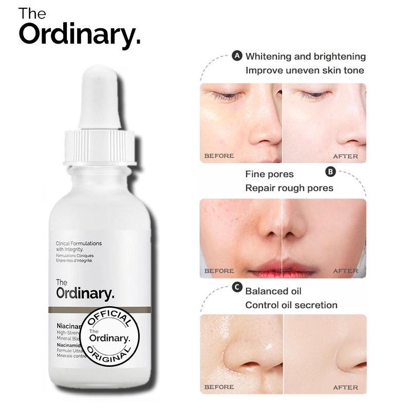 The Ordinary Niacinamide 10%+Zinc1% (Face serum 30ml )